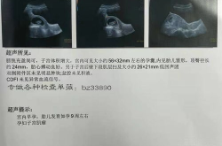 怀孕图片,怀孕图片中的温馨瞬间