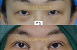 开眼角北京,探寻古都新韵，品味生活百态